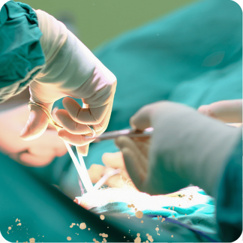 Surgery for Diastasis Recti